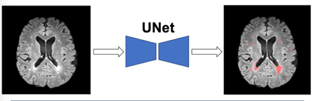 UNet